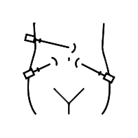 laparoscopic surgery